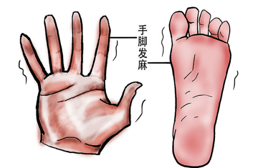 手腳經常發(fā)麻是什么原因?手腳發(fā)麻可能患有哪些疾病？